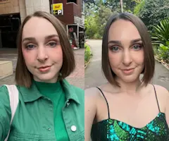 I Messed up My Skin When I Went Overseas, This Is How I Returned It to Its Former Glory