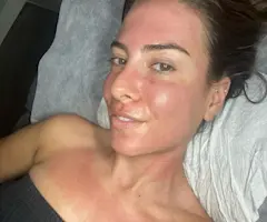 An Honest Guide to Skin Needling, My Favourite Skin Treatment of All Time
