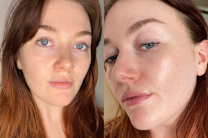 How to Prep My Dry Skin Before I Put on Makeup