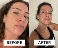 I Tried A Daily Salicylic Acid Toner To See If It Could Reduce My 