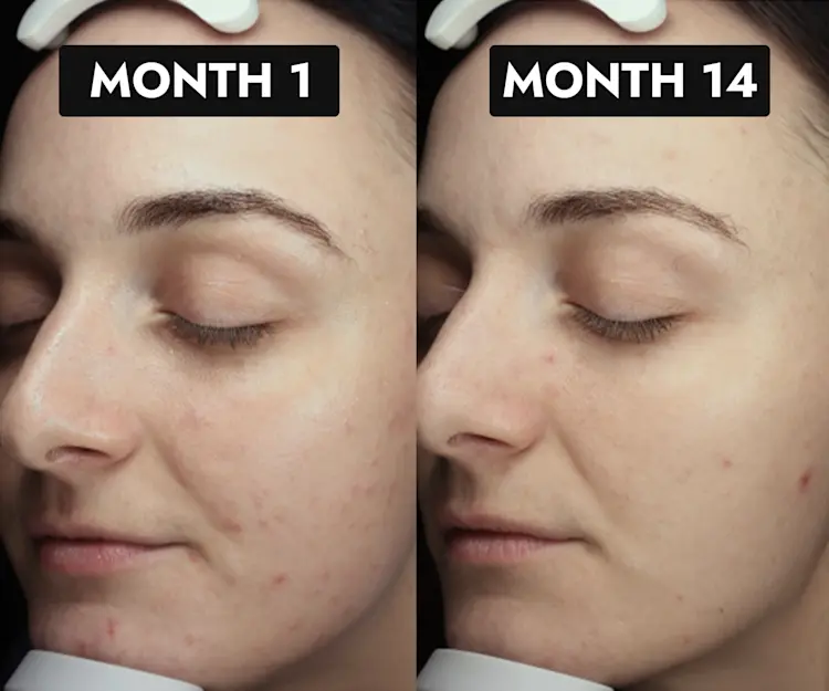 adore beauty article image