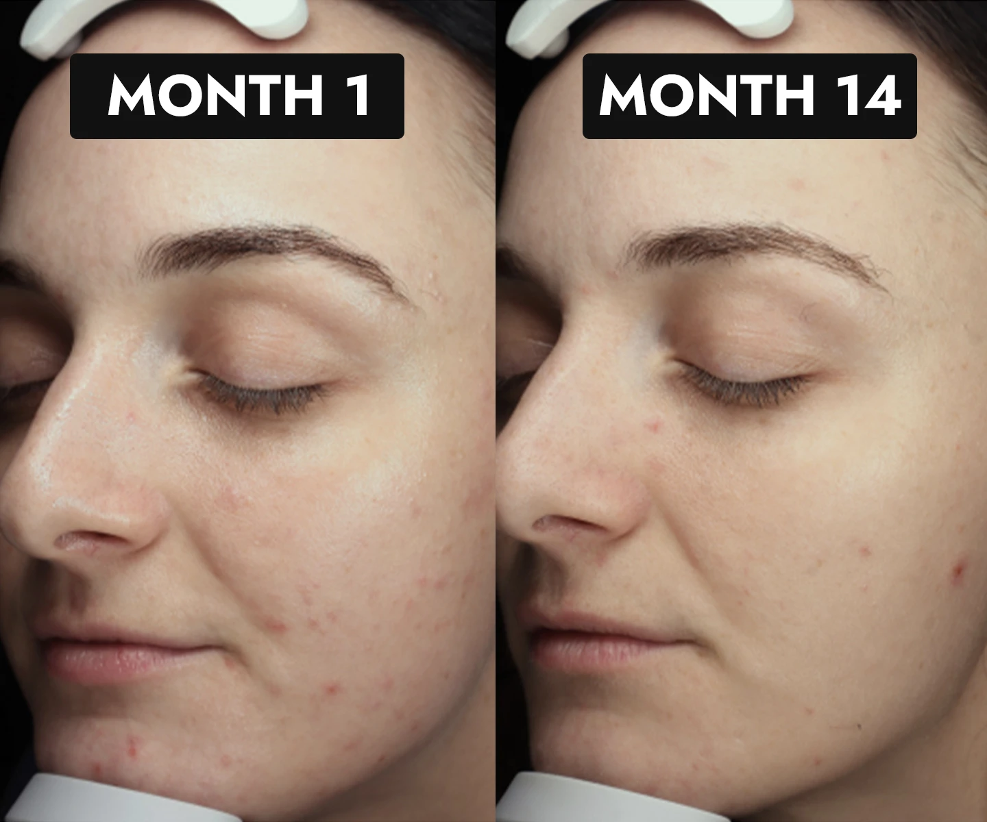 adore beauty article image