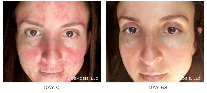 adore beauty article image