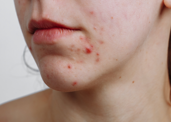 adore beauty article image