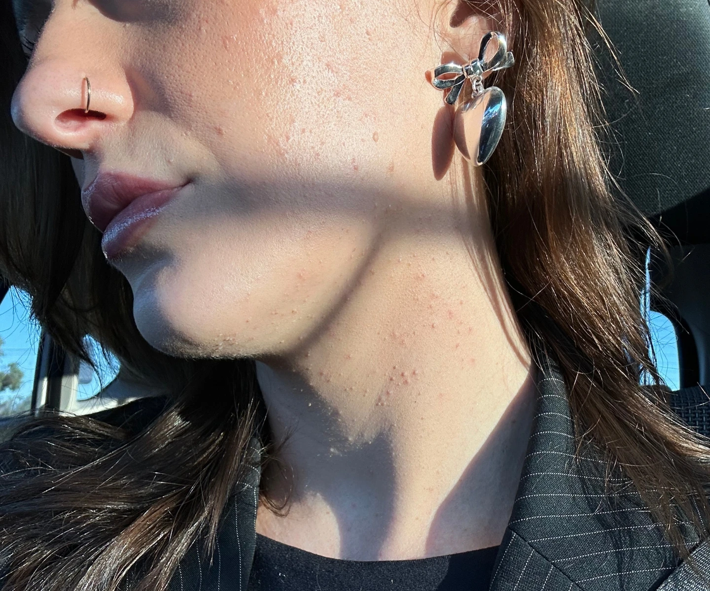 How Stress Affects the Skin (And What You Can Do About It)