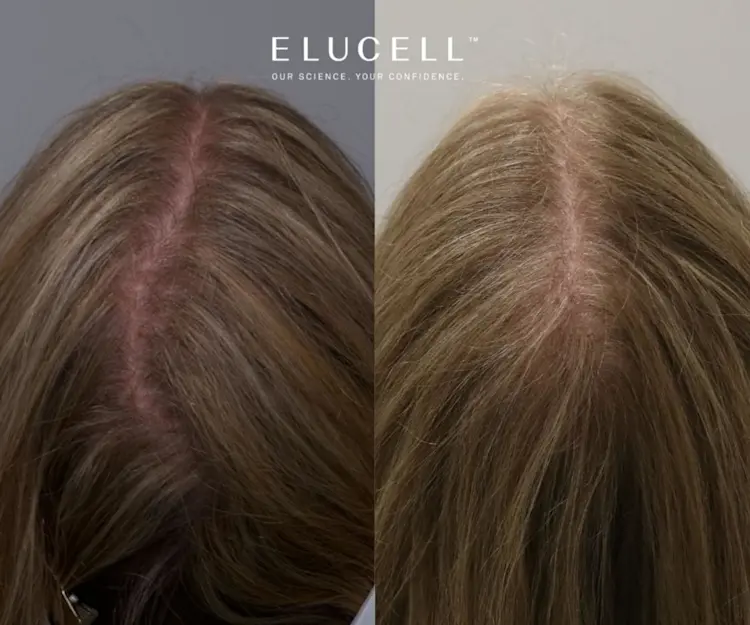 adore beauty article image