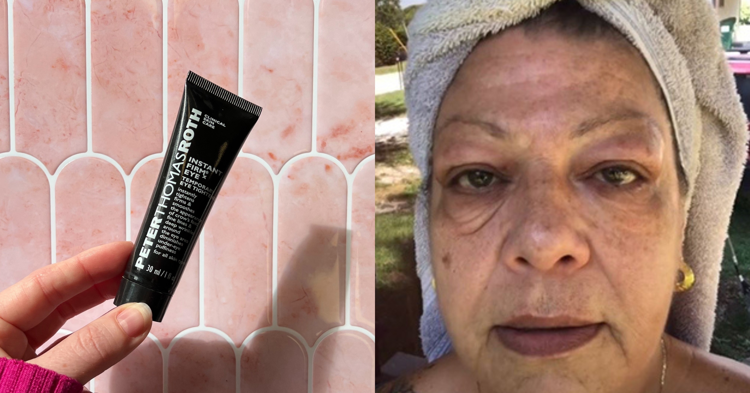 4 People Try the Viral Peter Thomas Roth Instant Eye Wrinkle