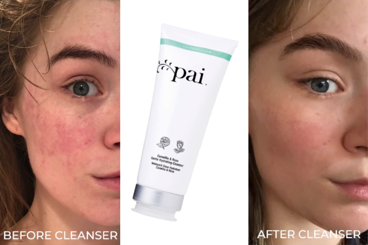 Adore Beauty Skincare Routine For Dry, Sensitive Skin Types - Pai Camellia & Rose Gentle Hydrating Cleanser - before and after