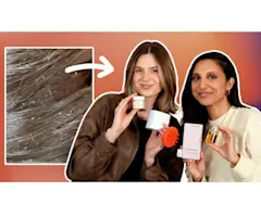 VIDEO: How I fixed my dry, itchy scalp! | My scalp care hair routine