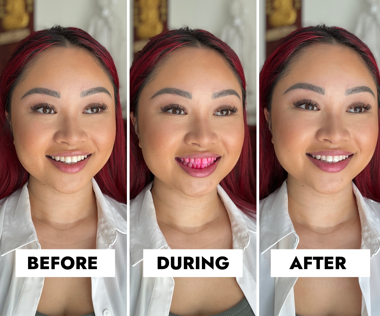 My Verdict on the Hismile Stain Eraser That Promises Healthier and Whiter  Teeth