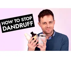 VIDEO: Here's how I fixed my itchy, flaky scalp!