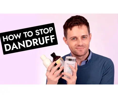 Beauty IQ Article - VIDEO: Here's how I fixed my itchy, flaky scalp!