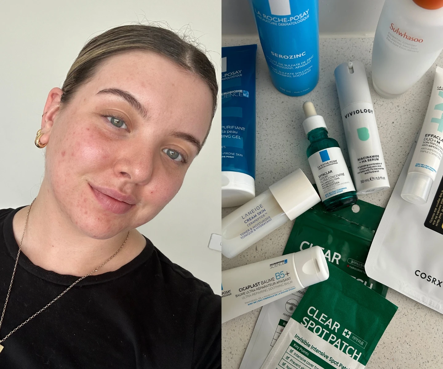 Skincare That’s Been Great for My Breakout-Prone Skin