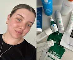 Beauty IQ Article - Skincare That’s Been Great for My Breakout-Prone Skin