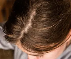 The 9 Best Products for Fast Hair Growth Australia in 2025