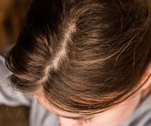 The 9 Best Products for Fast Hair Growth Australia in 2025