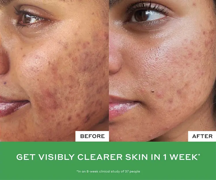 adore beauty article image