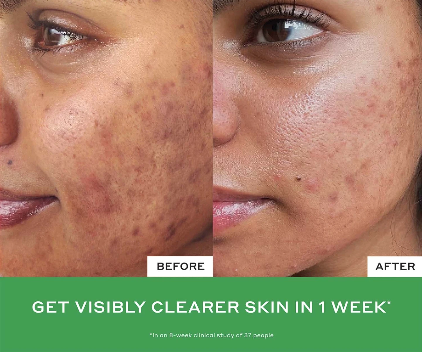 adore beauty article image