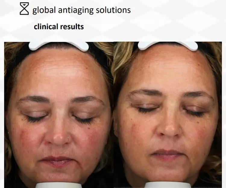 adore beauty article image