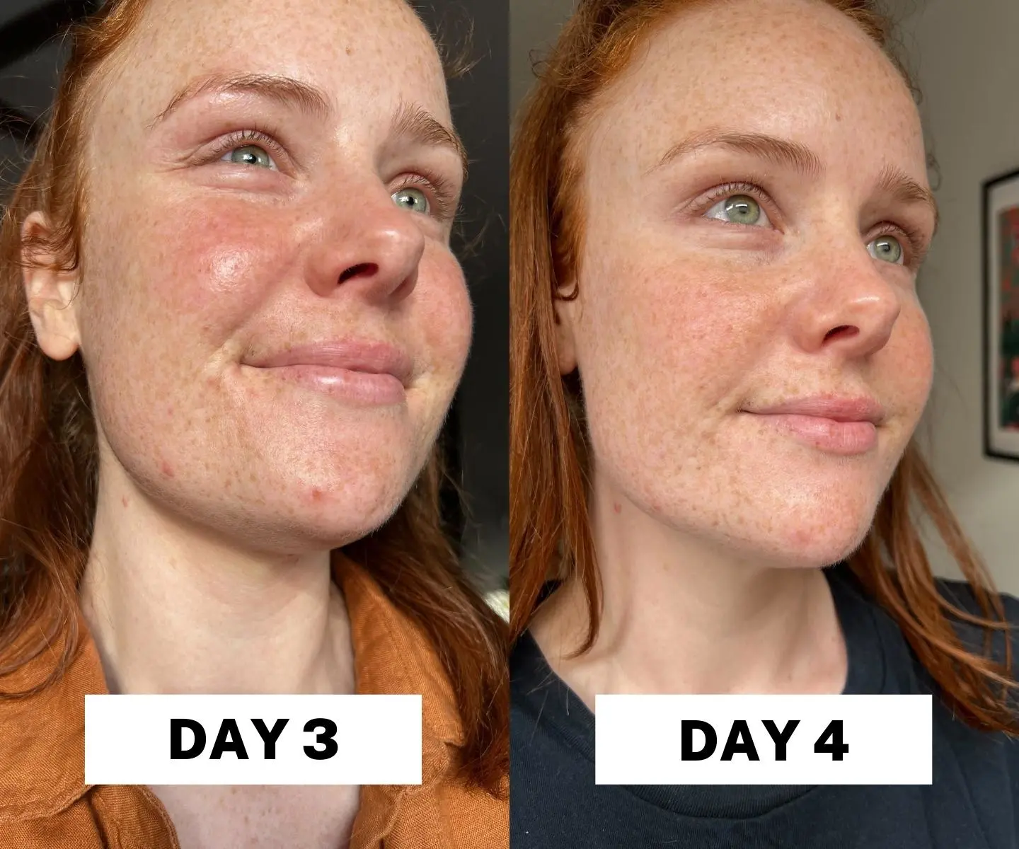 adore beauty article image