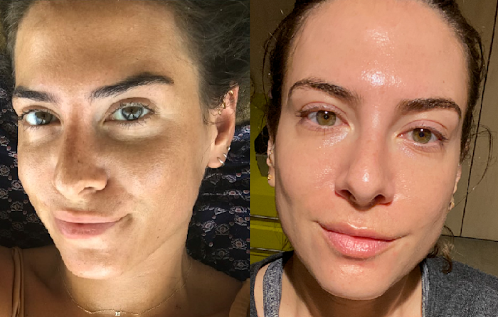 How My Skin Age Went From 36 To...