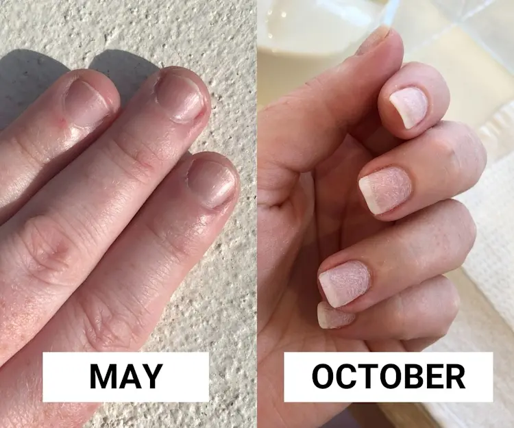 Image comparing nail regrowth after getting BIAB manicures. 