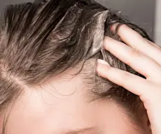 Beauty IQ Article - 8 Popular Skincare Ingredients That Are Just as Good for Your Hair & Scalp