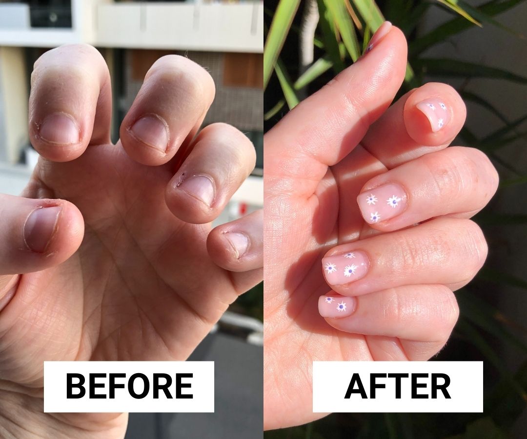 Share more than 130 biting acrylic nails off super hot