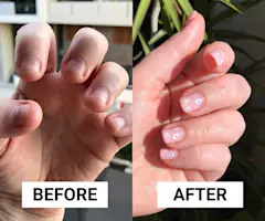 How to Stop Nail Biting: After 20 Years, This Is How I Finally Broke My Biting Habit