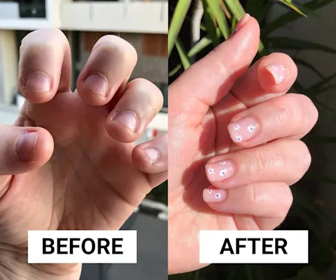 Beauty IQ Article - How to Stop Nail Biting: After 20 Years, This Is How I Finally Broke My Biting Habit