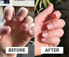 Beauty IQ Article - How to Stop Nail Biting: After 20 Years, This Is How I Finally Broke My Biting Habit