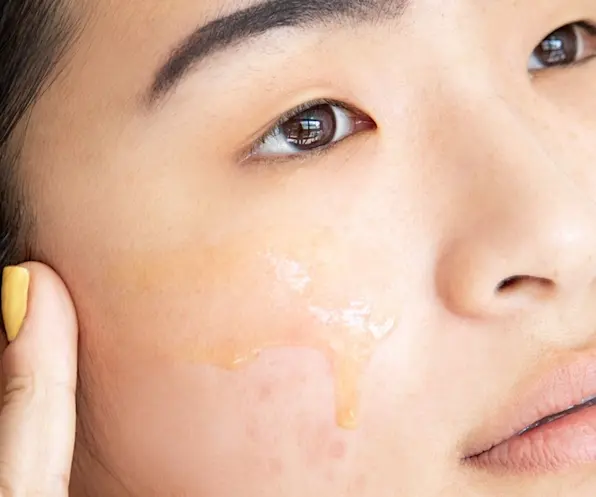 A Dermal Therapist Answers Your Post-Inflammatory Hyperpigmentation (Acne Scar) Questions