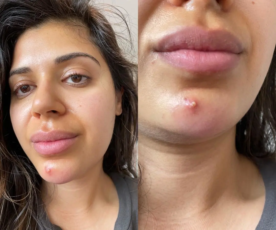 adore beauty article image