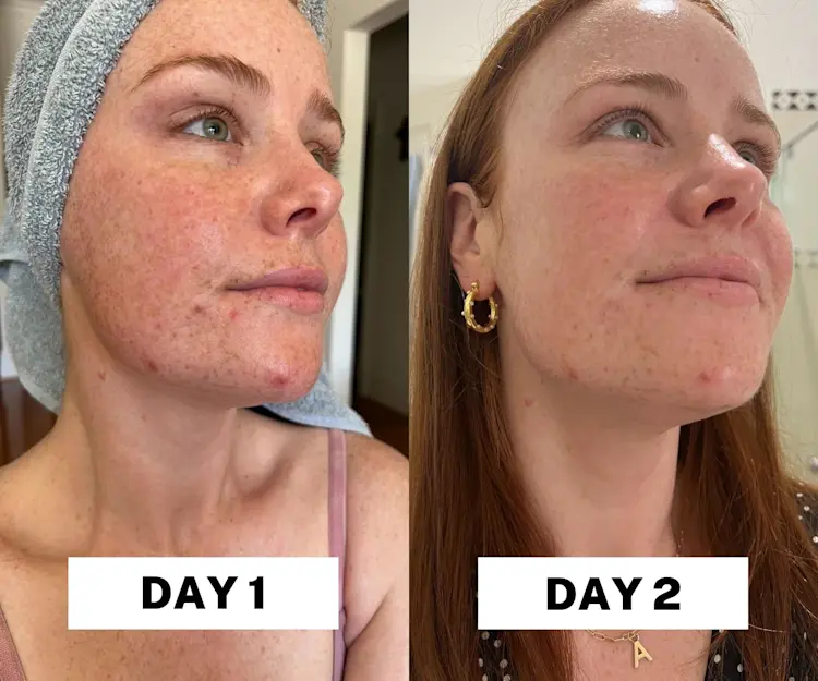 adore beauty article image