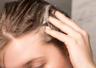 Beauty IQ Article - The 10 Best Sulphate Free Shampoos for Fine Hair in 2020