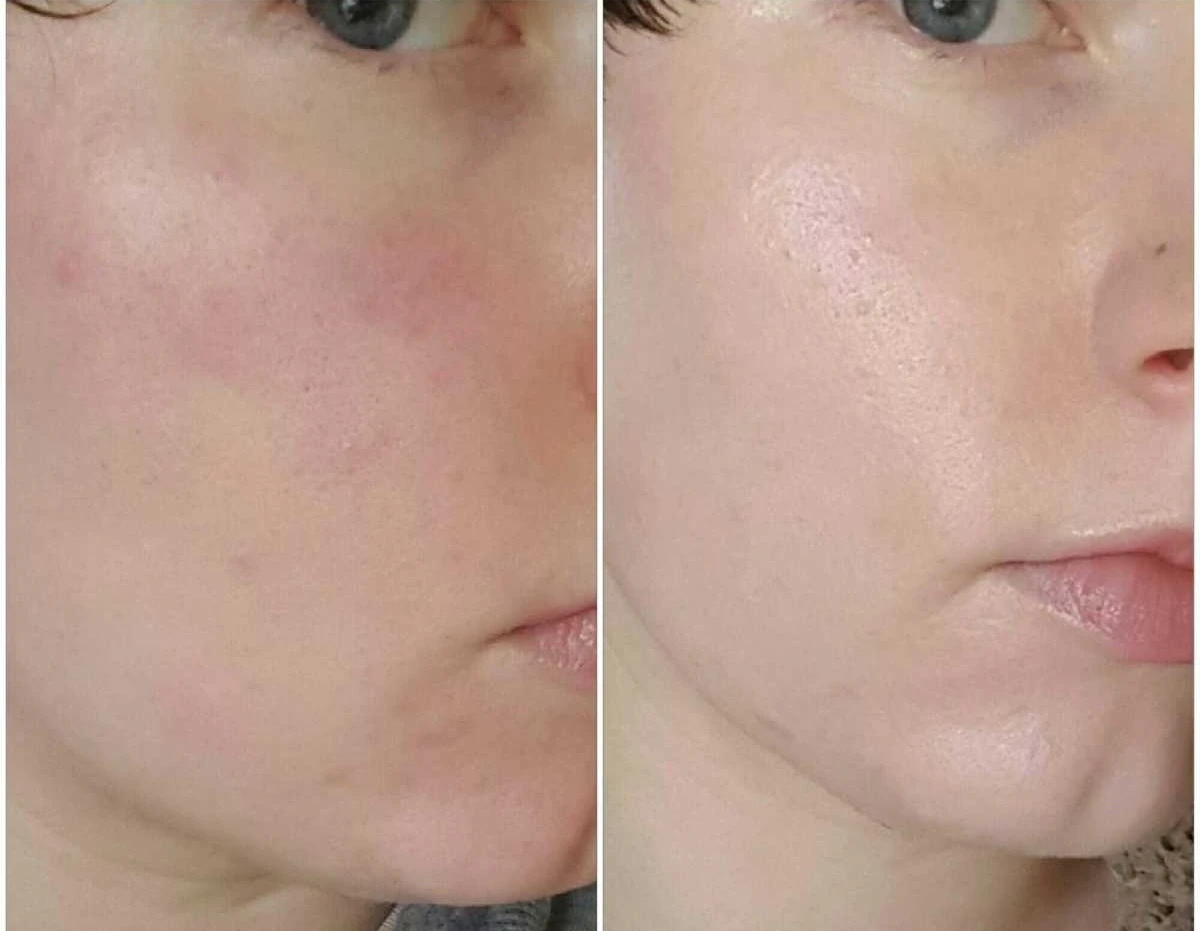 adore beauty article image