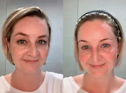 Beauty IQ Article - How to Care for Combination Skin with Alpha-H Skincare