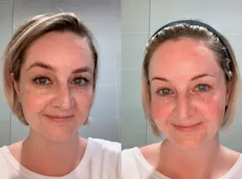 How to Care for Combination Skin with Alpha-H Skincare
