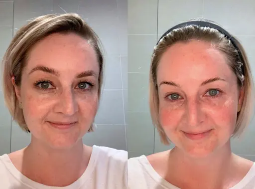 Beauty IQ Article - How to Care for Combination Skin with Alpha-H Skincare