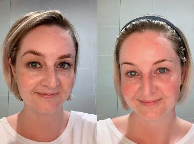 How to Care for Combination Skin with Alpha-H Skincare
