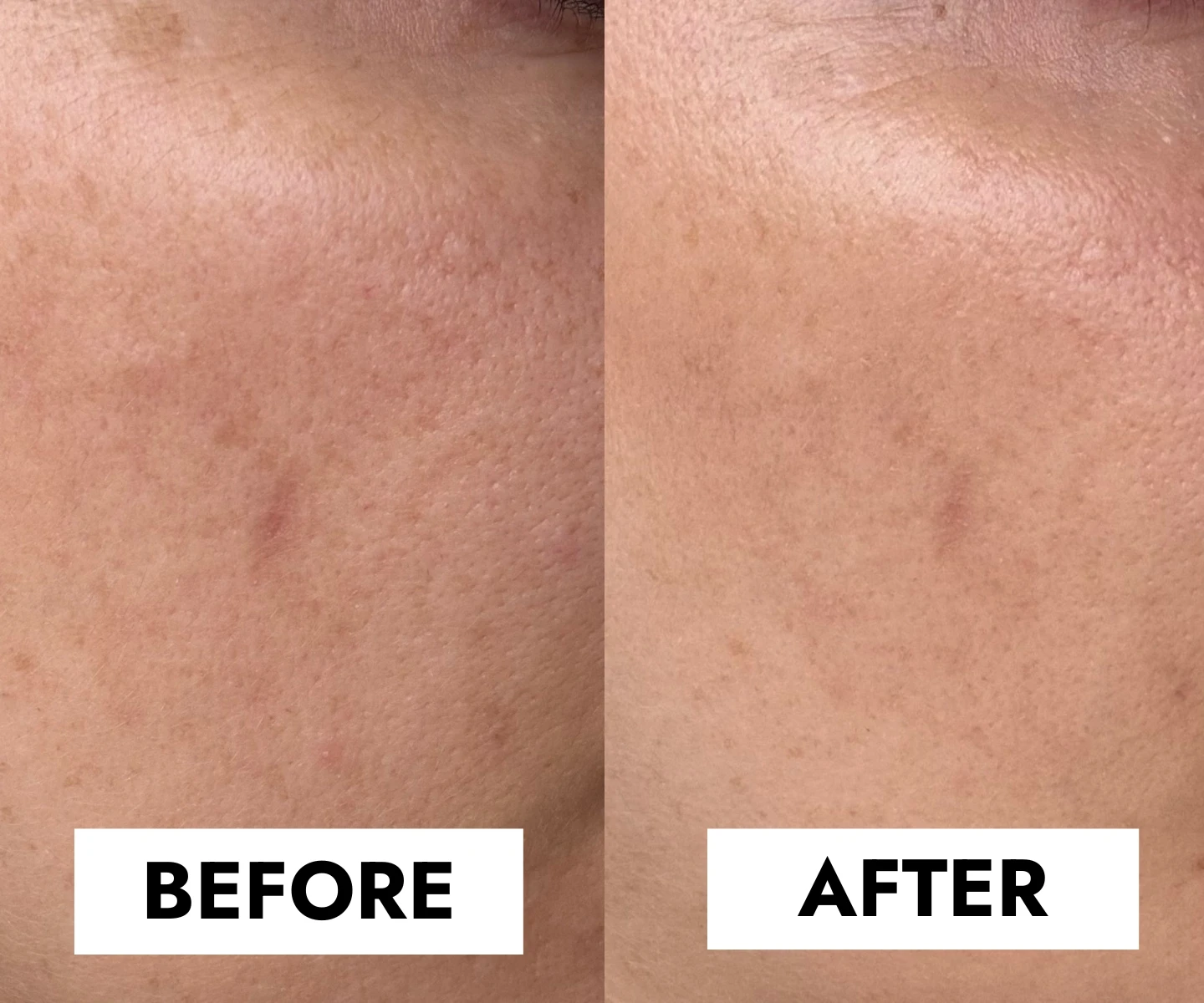 adore beauty article image