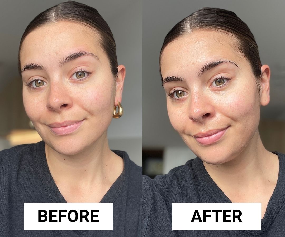 minennsey sheet mask before and after