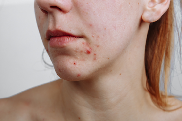 adore beauty article image