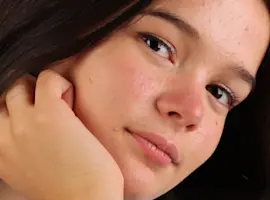 Whiteheads vs Blackheads: What's the Difference?