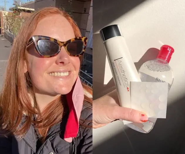 4 Products My Pimples Didn't Know They Needed (And Why They're So Bloody Good)