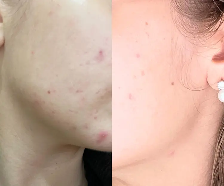 adore beauty article image