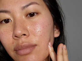 Find the Best Acne Scar Treatment for You