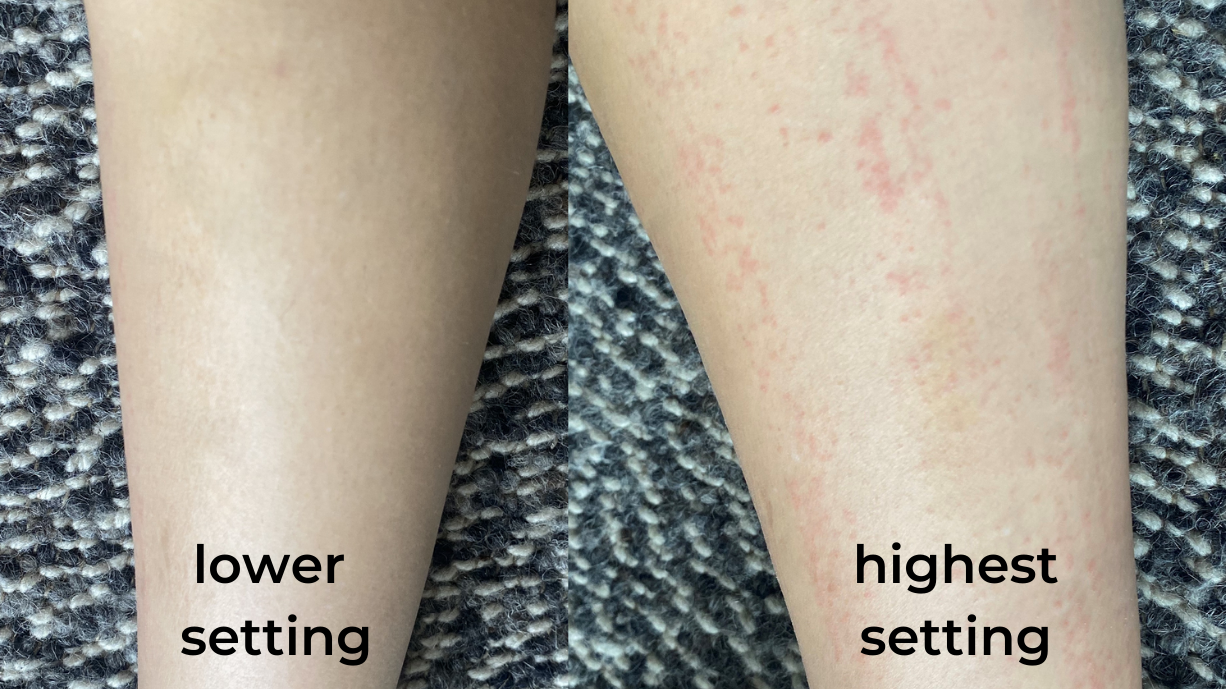 Do At-Home Laser Hair Removal Devices Actually Work?