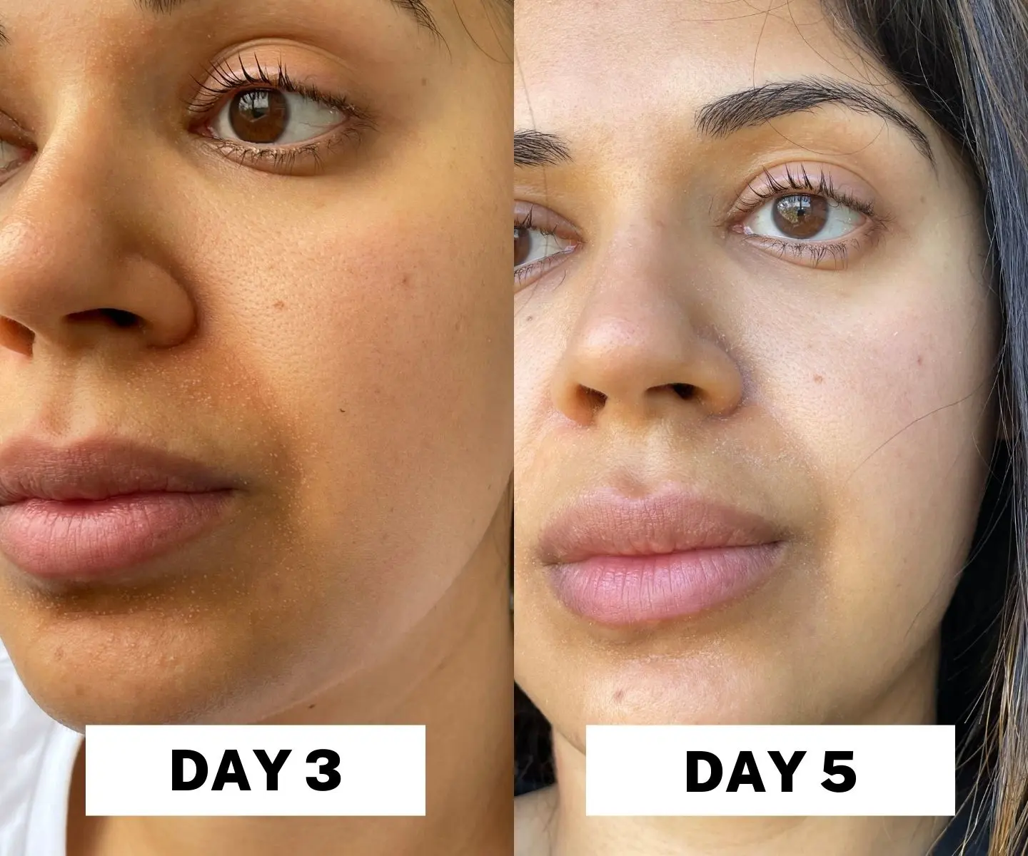 adore beauty article image