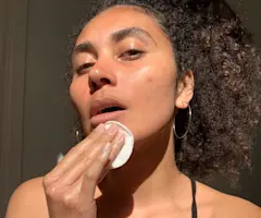 3 Different Types of Pimples & Exactly How to Manage Them
